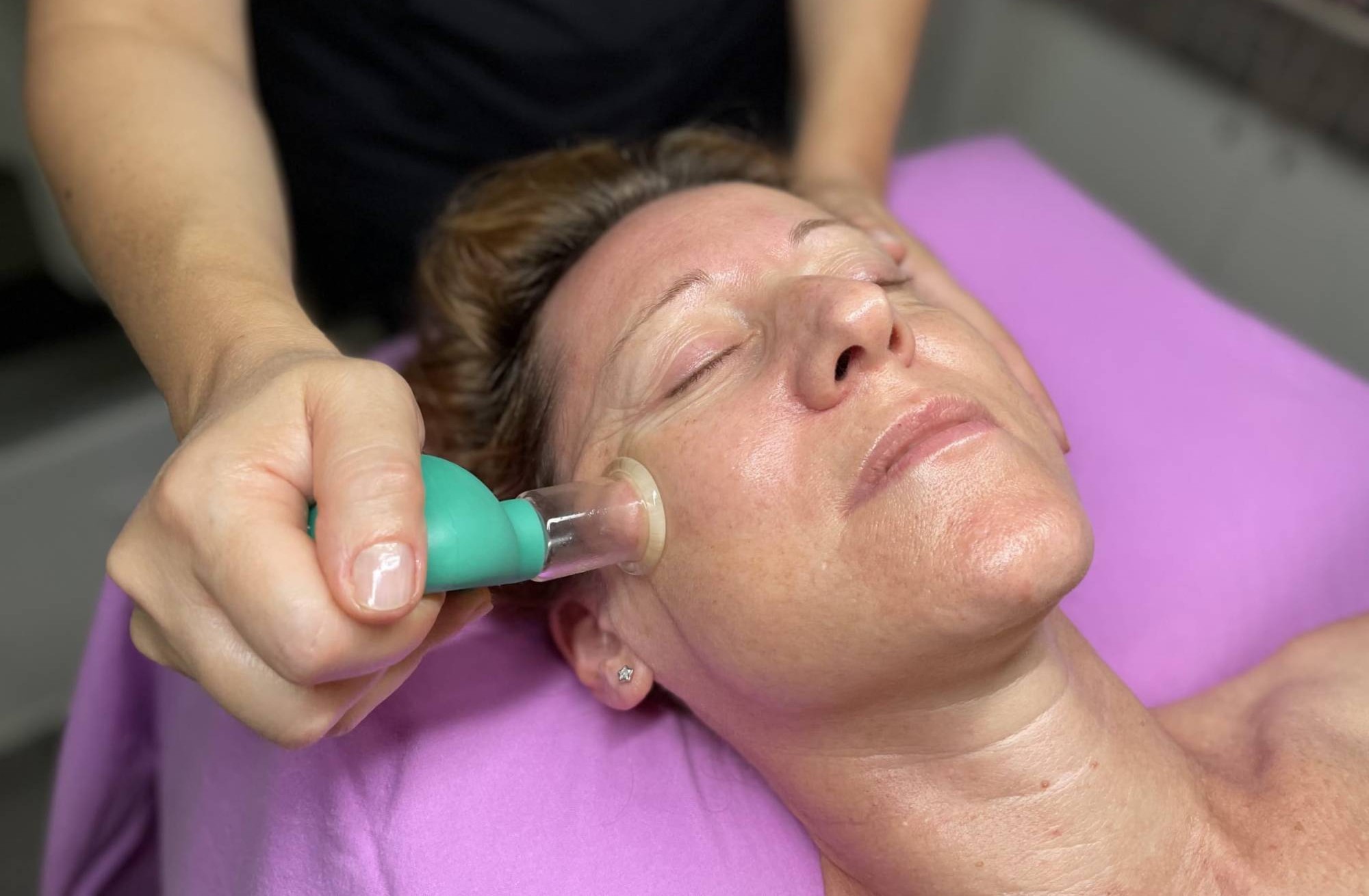 Trattamento Face Cupping